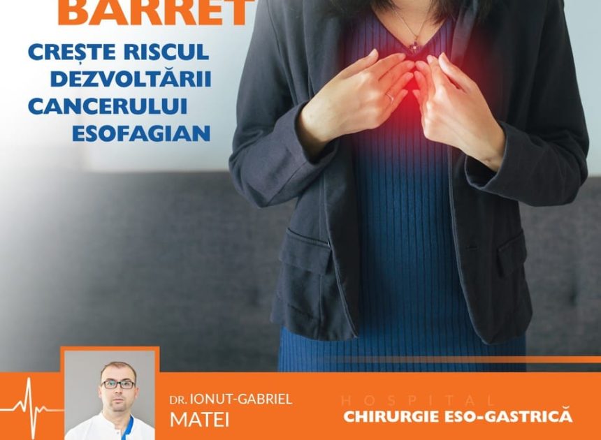 Esofagul Barrett