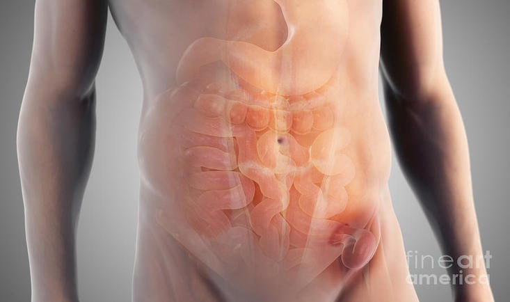 Operatie hernie inghinala|Hernia inghinala-Dr.Gabriel Matei