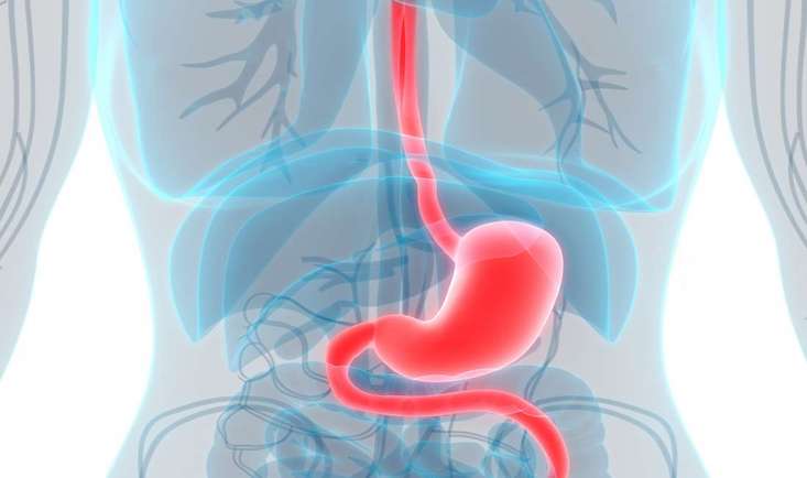Acalazie esofagiana|acalazie cardia|Achalasia_Laparoscopic Myotomy