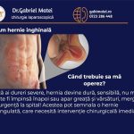 Am hernie inghinală. Când mă operez?