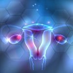 Endometrioza