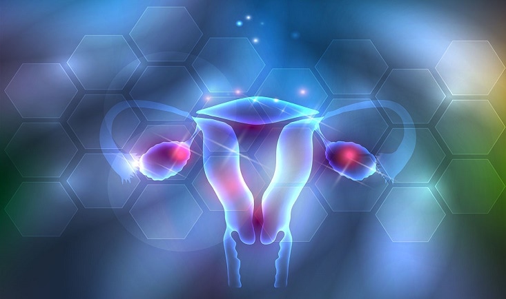 Endometrioza