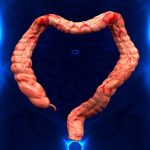 Diverticulita|echelon_flex_endopath_-_hero