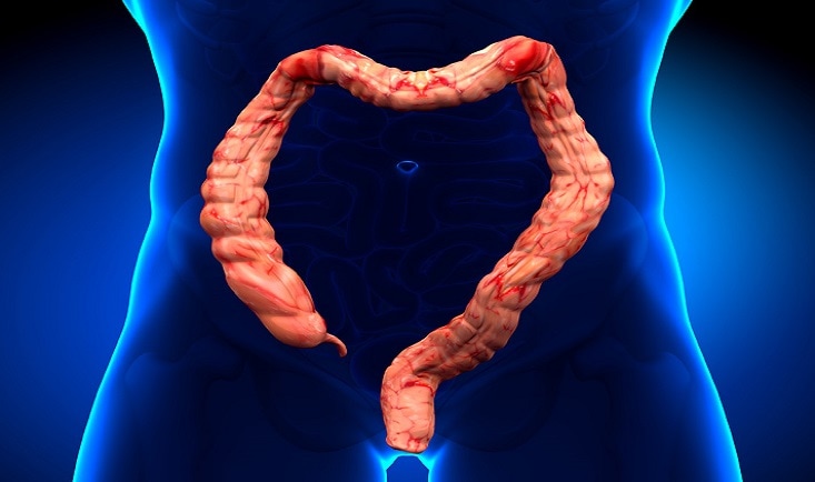 Diverticulita|echelon_flex_endopath_-_hero