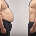 weight-loss-consultation