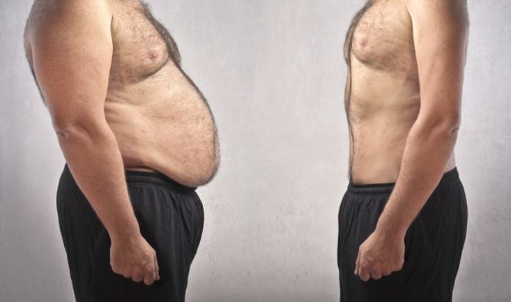 weight-loss-consultation